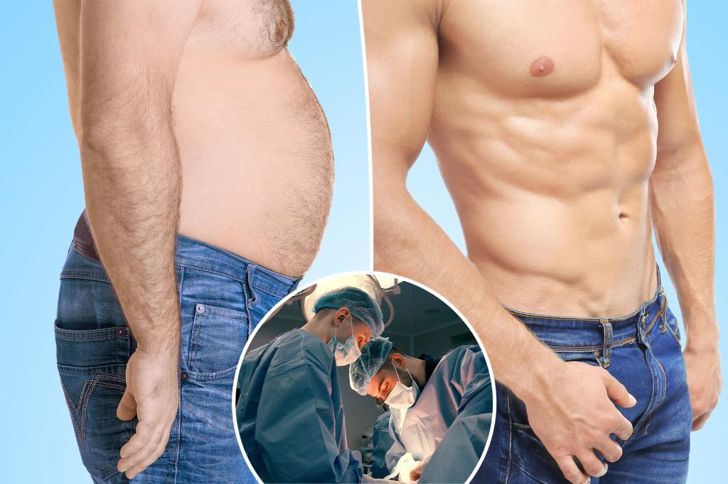 Surgeons say 'six-pack surgery' is more popular than ever among men